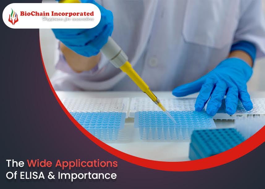 ELISA Kit Significance, Procedure Involved & Choosing The Right Kit