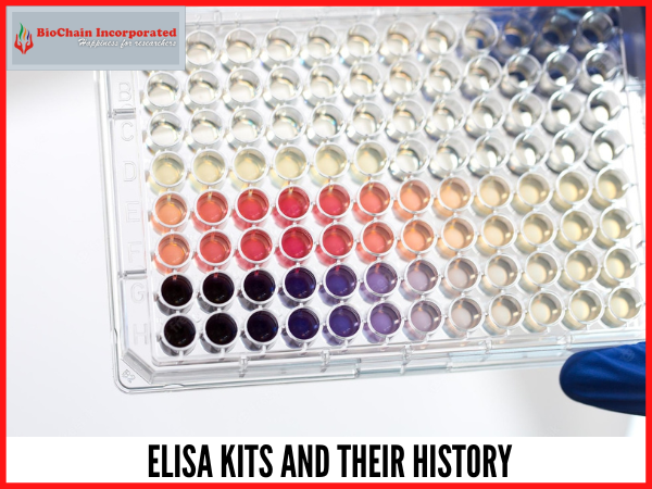 Interesting Facts About ELISA Kits We Bet You Never Knew