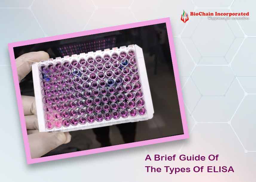 Summarizing The Considerations & Procedures Of ELISA Types