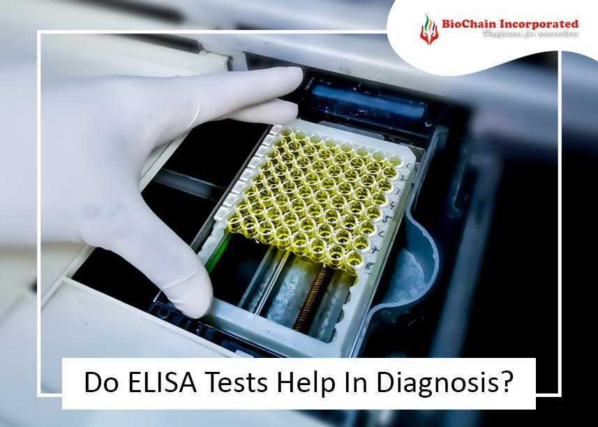 The Functions Of An ELISA Test: What Should You Expect From It?