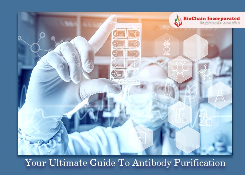 Experiencing The Different Techniques For Purifying Antibodies