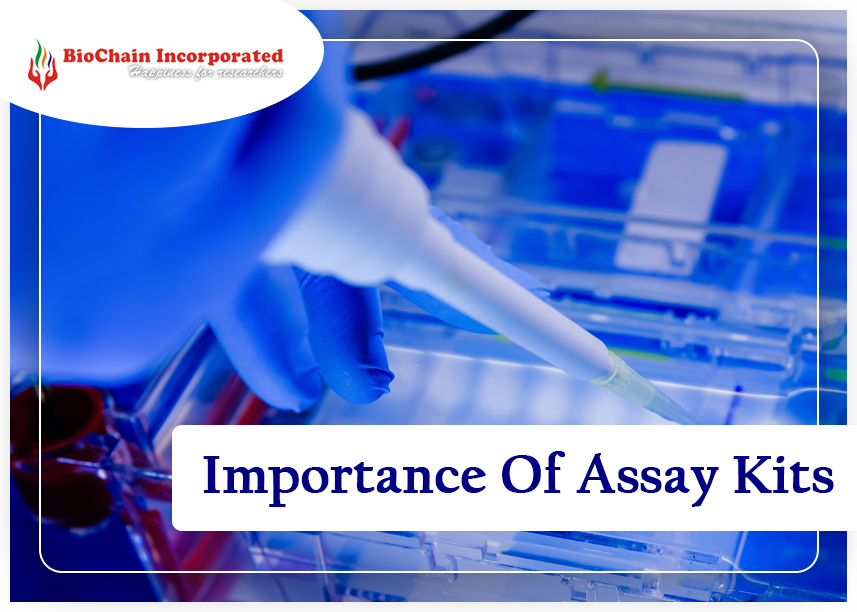How Dominating Are Assay Kits In The World Of Medical Science?