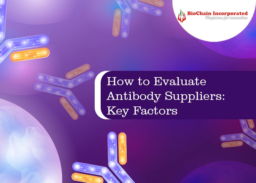 How to Evaluate Antibody Suppliers