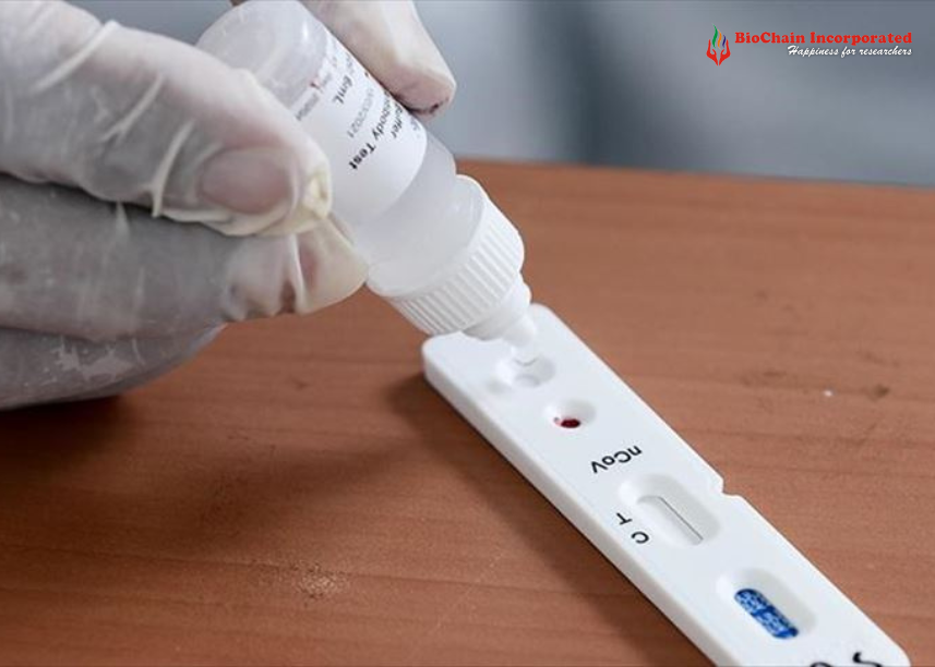 Affordable and Accurate: Why Choose Indian Rapid Test Kit Manufacturers? 