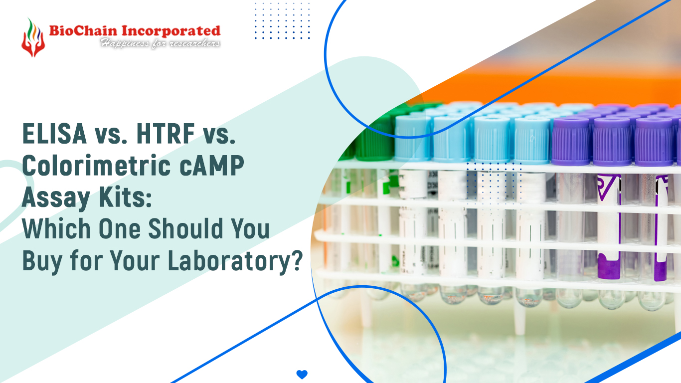ELISA vs. HTRF vs. Colorimetric cAMP Assay Kits: Which One Should You Buy for Your Laboratory?